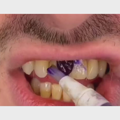 Fioletowy pisak wybielający Dentini Smile™
